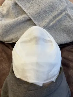 美白✕ハーブピーリング🌿モニター！剥離なし、DTなし！※モニター価格のため現金 or PayPay支払いのみ