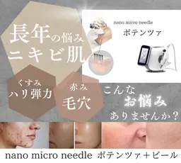 🫧エステポテンツァ🫧ニキビ・ニキビ跡・毛穴・透明感・シワ・ハリ弾力