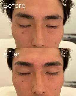 ❤️🔥予約殺到中❤️🔥メンズ眉毛ワックス脱毛