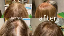 50人カラーチェック白髪染めリタッチ🕊️🕊️残り20人!ワンポイントでも構いません!一緒に綺麗を作りましょう