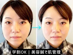 【学割U24⏱】授業/バイト前に｜むくみオフ小顔(EMSなし) 25分