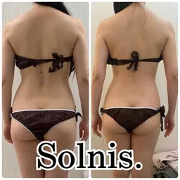 👑全身人気NO1👑ハイパーシェイプ🩷メスを使わない脂肪吸引🩷徹底全身しっかり施術90分‼️