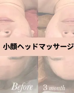 糸リフト不要❌小顔ヘッドマッサージ💆‍♀️