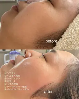 フェイスワックス！鎮静クリームパック付き✨フェイスワックスでしか手に入らないツルツル素肌を体感してくださいませ🤭