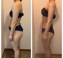 【口コミ+写真】姿勢改善+骨盤矯正