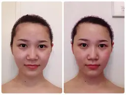 顔+デコルテ＋ヘッドセラピー(ツールなし)