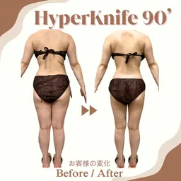 🌸3月限定🌸ハイパーナイフ90分◇全身+デコルテ◇痩身|むくみ|疲れ|部分やせ|体質改善|トータルケア