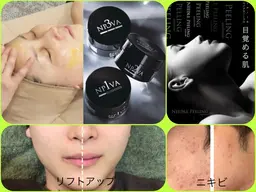 【毛穴開き】ニキビ】【ニキビ跡】針ピーリング✨マイクロニードル1500万本導入❣️高濃度ビタミンAとマイクロ針で速攻実感
