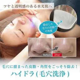 人気No.1🥇【黒ずみ、角栓、ざらつき解消】ハイドラ洗浄でごっそり毛穴汚れを除去！透明感のある潤ったお肌へ✨