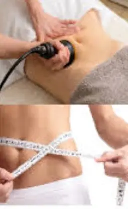 ✨ミニモ限定価格✨痩身RF+キャビRF+🎁ミニモ特典+ヒト脂肪順化培養液エッセンスパック付き(1部位)