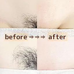 【モニター様価格】うなじ+顔シュガーリング🍋