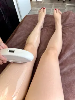 【学割】全身脱毛