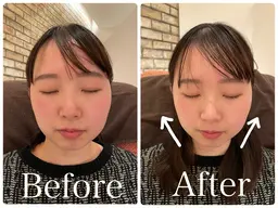 女性のためのリフトUPコース