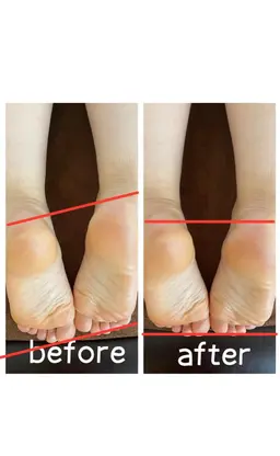 【整体40分 ￥2980】かけつけ！！(骨盤矯正+もみほぐし)