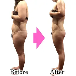 夏太り解消！！ハンドとマシンで短期集中・超得【70分×2日】🍀激やせW全身痩身🍀