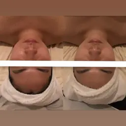 【透明感×小顔】ミニモ限定特別メニュー‼️全身トータルケアエステ💆🏻♀️🫧 乾燥はもちろん、むくみもすっきり✨