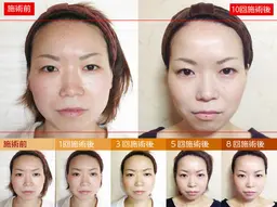 ミニモ限定✨💆《小顔コルギ＋ボディコルギ＋1箇所矯正付き》2回コース💙通常25,000→9,800円