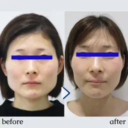 初回限定★全国人気NO.1！【小顔矯正+美顔マッサージ】+【首肩矯正】✨ 50分