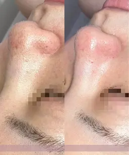 【美白|シミ|くすみ】facial 90min