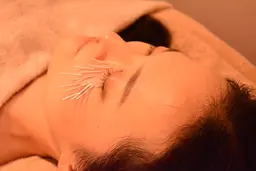 ✨minimo当日限定コース✨美容鍼デビューしませんか❓少しずつ始めるお試し20本プラン✨美容鍼ビギナーコース