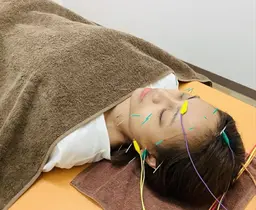 【美容鍼】