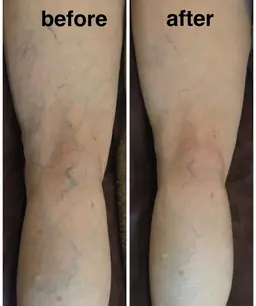 オールハンドリンパマッサージ