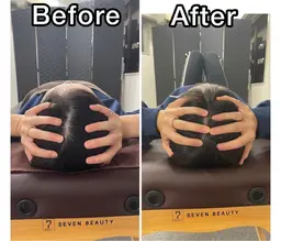 頭の整体（ドライヘッドスパ）