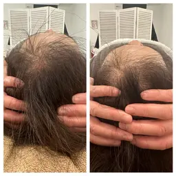 顔のむくみ、たるみ、ゆがみが気になる方に人気！美脳小顔矯正 3,900円