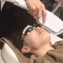 レディース顔脱毛+毛穴ケア