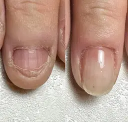 本気で変えたい方へ｜自爪育成　　　カウンセリング90分 ¥4,400