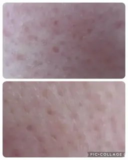 新規の方限定！人気No.1 お肌引き上げコース