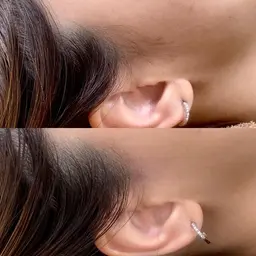 お顔のくすみ、産毛が気になる方募集⭐︎フェイシャルWax脱毛でお顔がツルツルに。