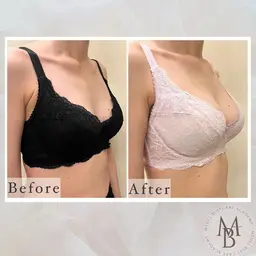 《3月限定》新年度に向けて印象up🫶バストケアトリートメント[90分]＋腸もみ[15分]《お写真提供OKの方》