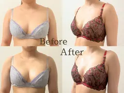 【10名限定】全身から整えるバストケア90分コース症例モニター