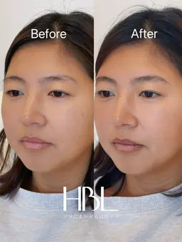 大型プロモーション企画《リピーター様💛》ハリウッドブロウリフト