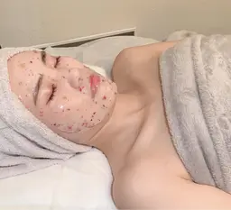 【フォト☆フェイシャル30分】シミ、くすみ、開き毛穴にラジオ派を真皮層にあてる美肌ケア◎