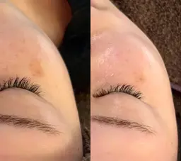 【リピーター多数❣️】💎ピーリング💎毛穴・乾燥小シワを内側から輝く肌に✨ヘッドマッサージ、足つぼ付き💆🏻‍♀️