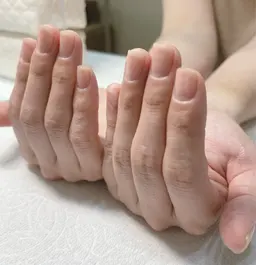 ネイルケア(爪周りの角質、甘皮ケア)