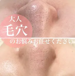 【本気毛穴ケア】毛穴集中洗浄全顔つるん。癒しのデコルテマッサージ付き　定価14,300円