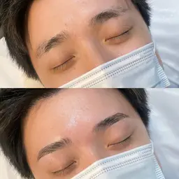 ハリウッドブロウリフト