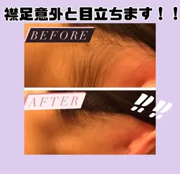 【気になる箇所★】えりあし脱毛体験