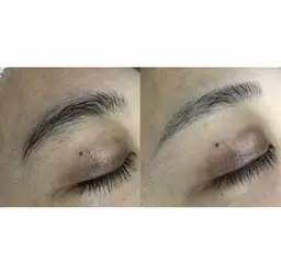 顔、襟レディースシェービング(女性限定)