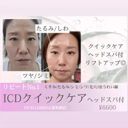 韓国整形級🇰🇷艶肌インセルダム クイックフェイシャル×ヘッドスパ🌿商品相談ももちろん可能💭リフトアップ/毛穴