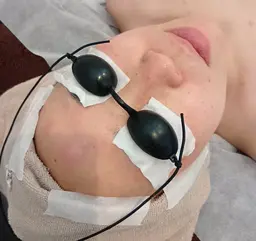 フェイシャルモデル相談⚠️必ず注意事項をお読みください