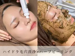 【毛穴/肌荒れ】ハイドラ毛穴洗浄+4種類肌悩みから選べるピーリング