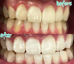 Ｂコース（8回）