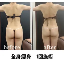 【男女/会食が増えるこの時期に】筋膜リリース全身痩身90分¥11000