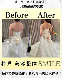 【初回限定】ブライダル整体