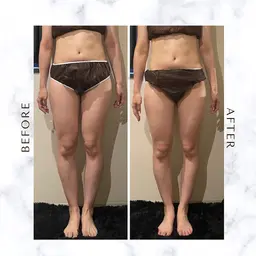 【🔥速攻サイズダウン🔥】強圧リンパマッサージ！60分