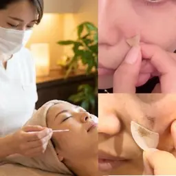 【新人クーポン2980円】最新シミケア★ホワイトラボ【顔1箇所】